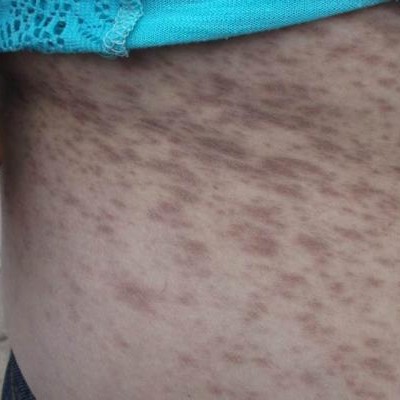  Detectan arsénico en sangre de pobladores de Sonora