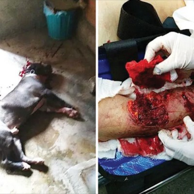  Pitbull le destroza el brazo a su dueña en el Edomex