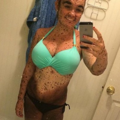  La han llamado ‘sucia’ y ‘perro moteado’ por su apariencia