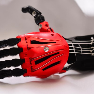  Pequeño de seis años recibe primera prótesis 3D en Francia