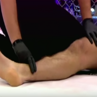  VIDEO: Espeluznante fractura en MMA