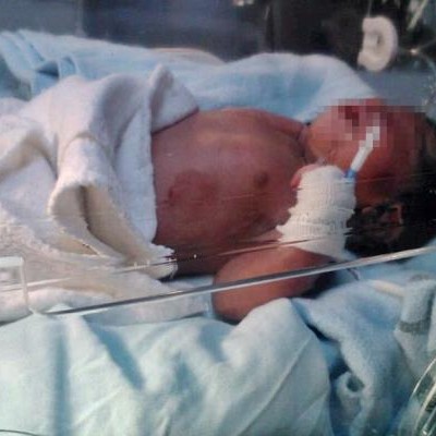  Parto ‘Post mortem’ salva la vida a bebé