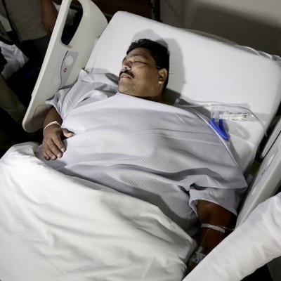  “Acabo de nacer”: hombre más obeso del mundo tras ser operado