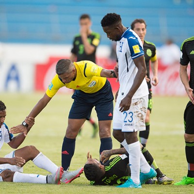  (Video) Escalofriante lesión de Garrido en el Honduras vs México