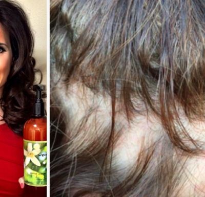  Cientos de mujeres demandan a marca de champú por estarse quedando sin cabello