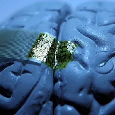  Construyen un implante cerebral que se disuelve