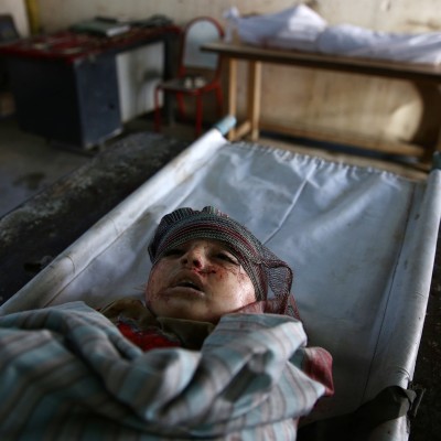  Al menos 50 muertos tras bombardeo a hospitales y escuelas en Siria