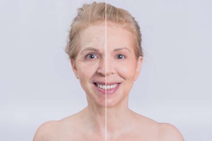  Crean “segunda piel” para eliminar arrugas de manera temporal