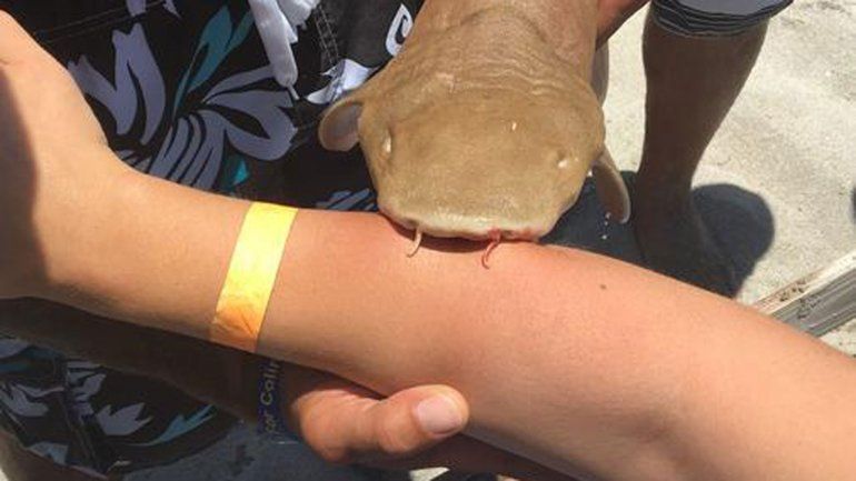 Mujer llega a hospital de Florida con tiburón sujetado a su brazo