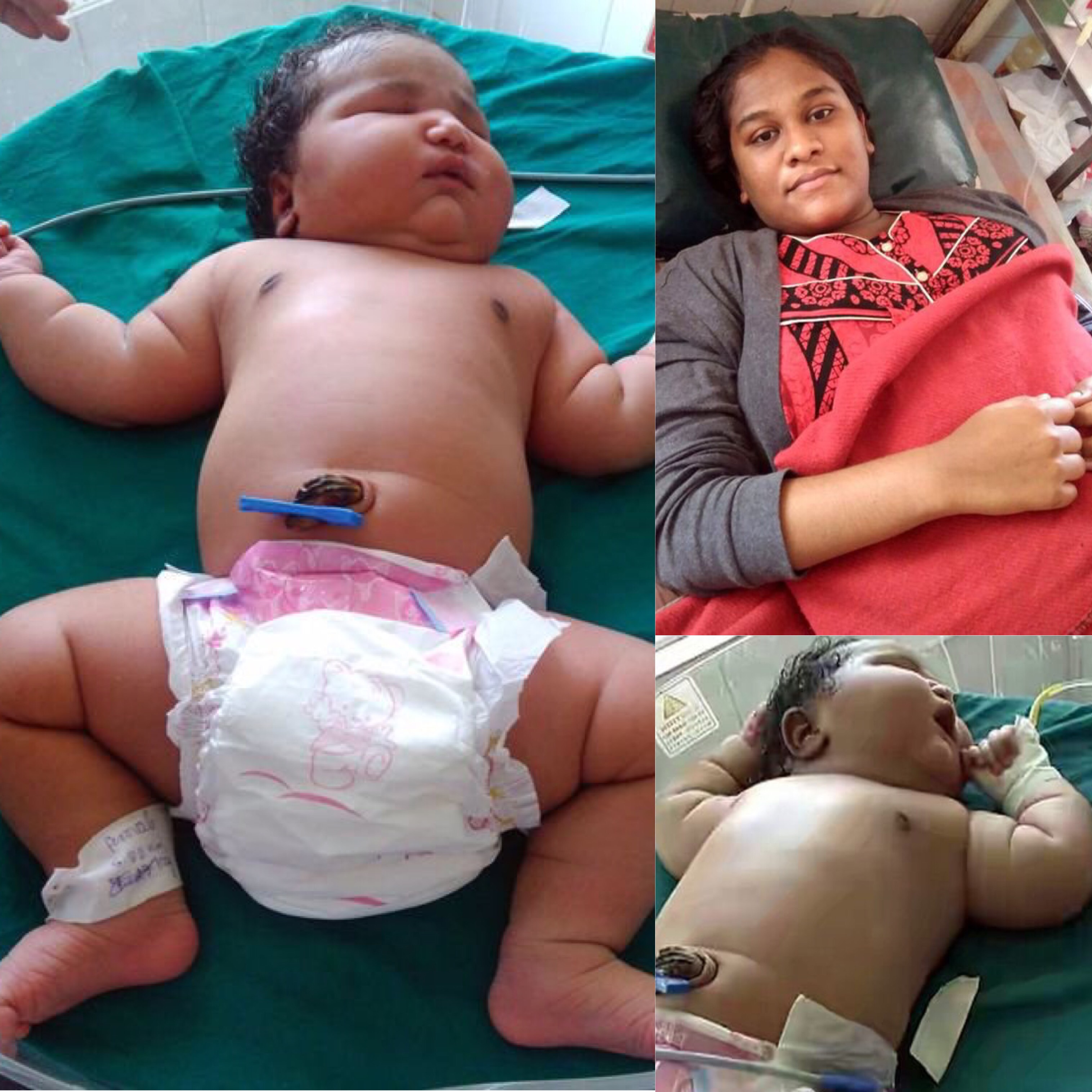  Nació la bebé más pesada del mundo; rompe récord