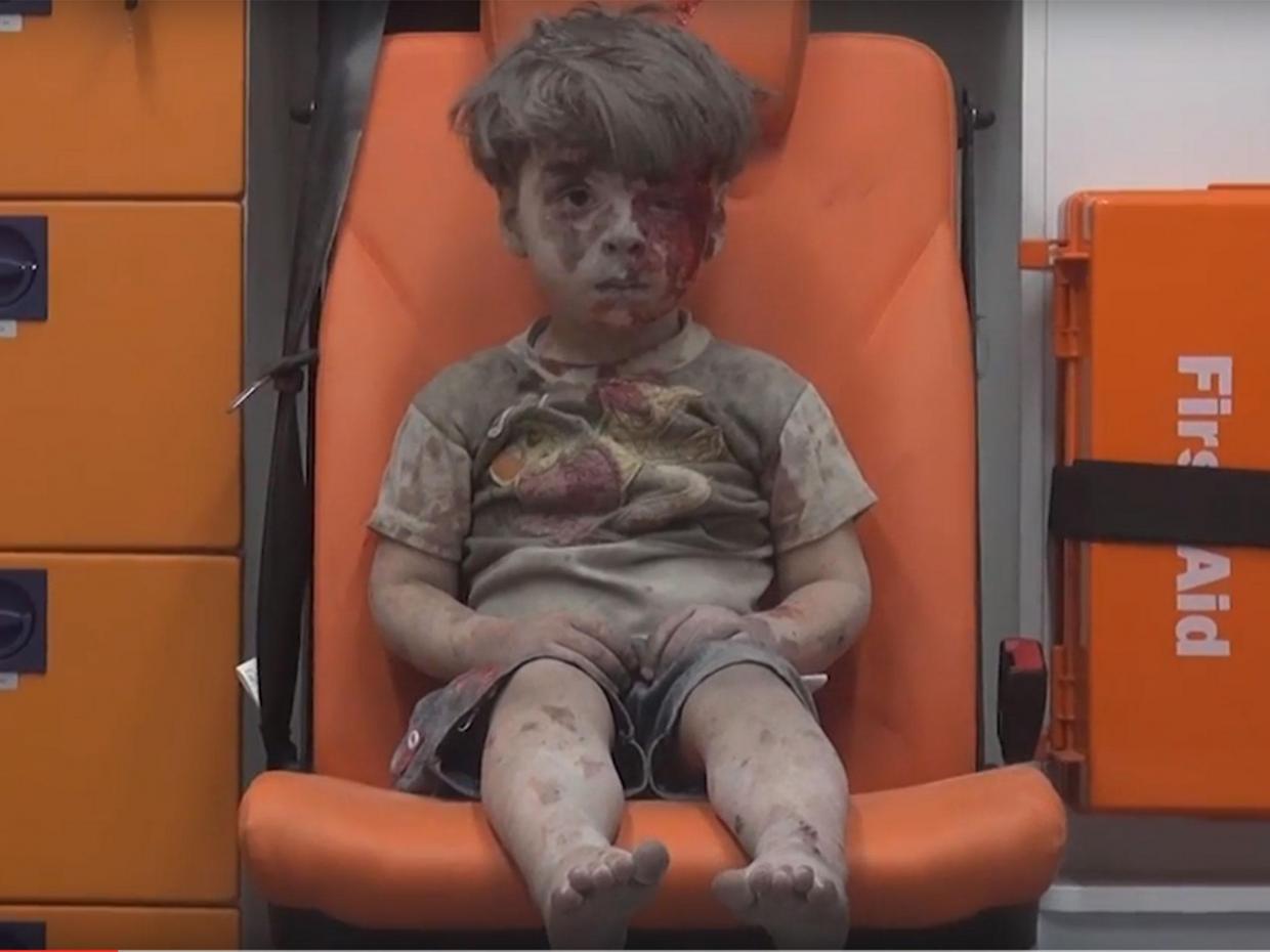  Hermano mayor de Omran, el menor sirio cuya foto se hizo viral, falleció por gravedad de sus heridas