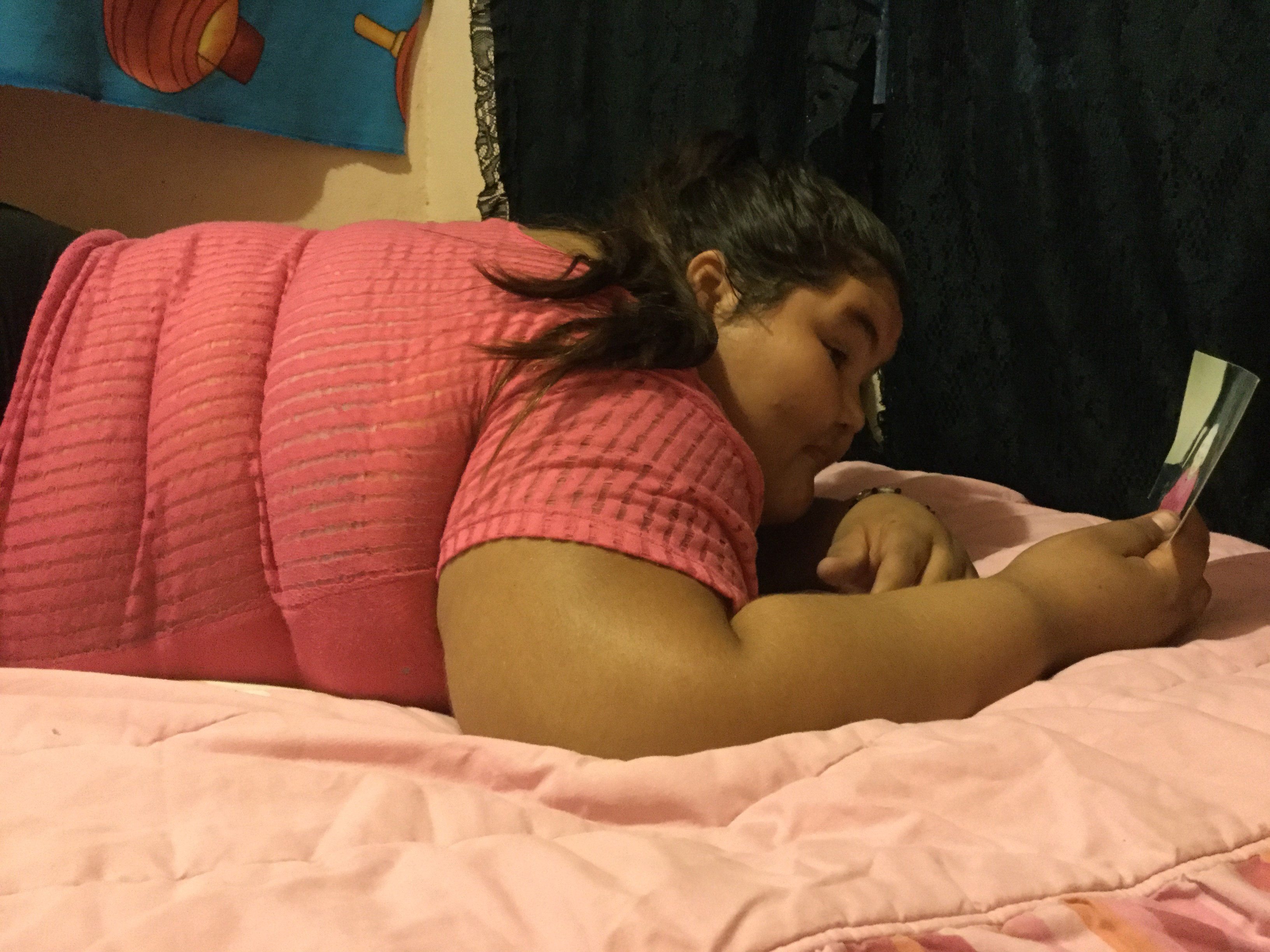  Operan en Jalisco a una de las adolescentes más obesas del mundo