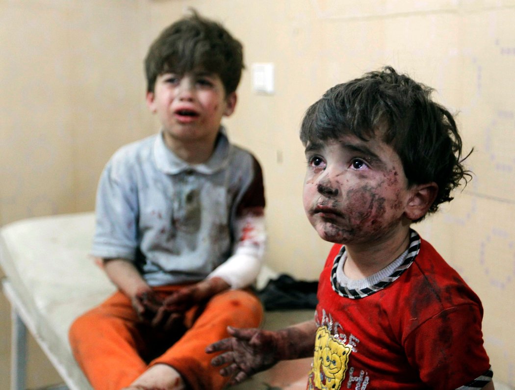  La lucha por Aleppo, un infierno para los niños sirios