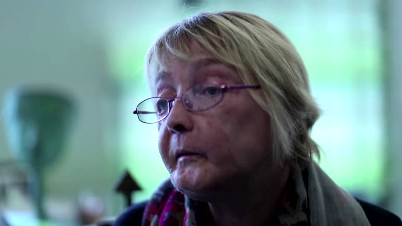  Muere la primera mujer que recibió un transplante de rostro en el mundo