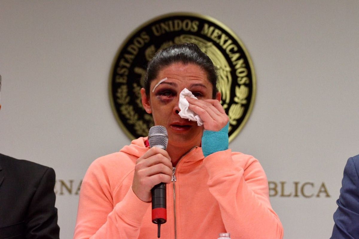  Ubican a dueña de auto de agresores de Ana Guevara