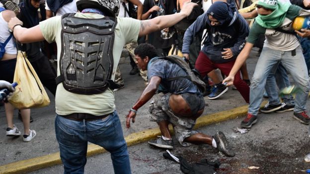  Durante protesta, prenden fuego a joven en Venezuela