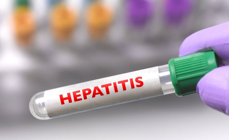  Confirma Salud aumento en casos de hepatitis A en SLP