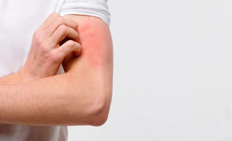  Investigadores del IPICYT trabajan en diagnóstico accesible para infecciones por hongos